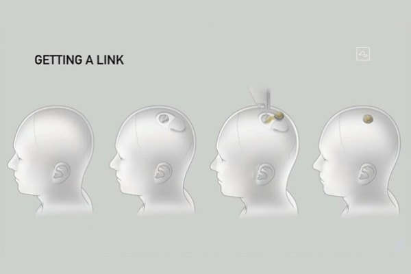 Ă la loupe đ #4 Transhumanisme : des pistes plausibles pour augmenter notre productivitĂ© ?