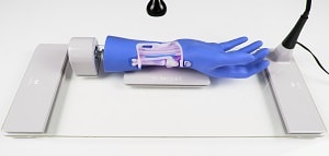 Biomodex a mis au point un simulateur de réparation de fracture distale du radius (poignet cassé). ©Biomodex