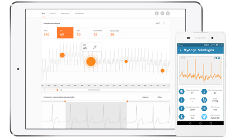 La start-up Devinnova (IoT pour la santé) a mis au point MyAngel Vitalsigns, un patch cutané à usage unique qui analyse les troubles du rythme cardiaque en vue de déceler le risque d’infarctus jusqu’à deux mois avant...